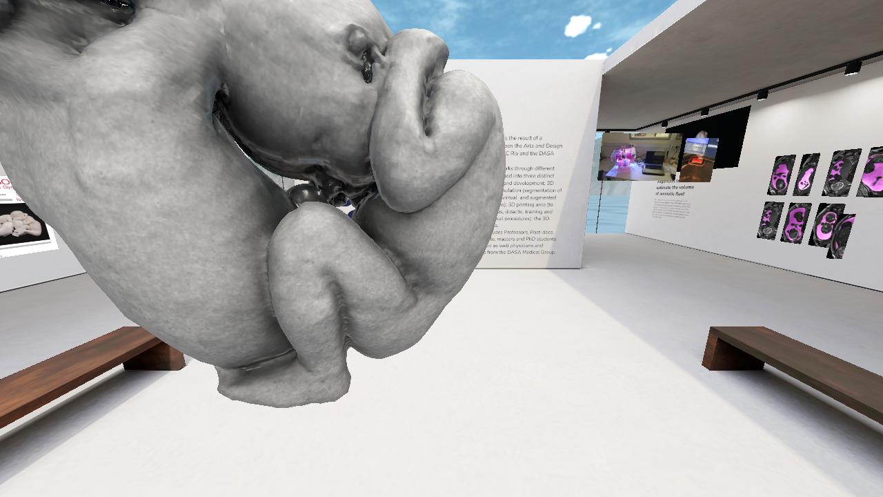 Biodesign Fetal
