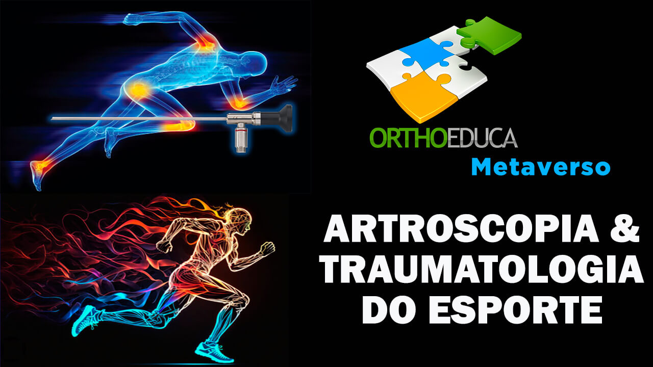 Artroscopia & Traumatologia do Esporte - OrthoEduca